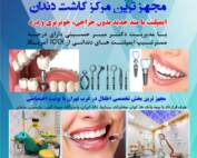 طراحی تراکت دندانپزشکی تهرانسر